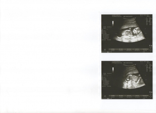 d78b87ff65288800med.jpg