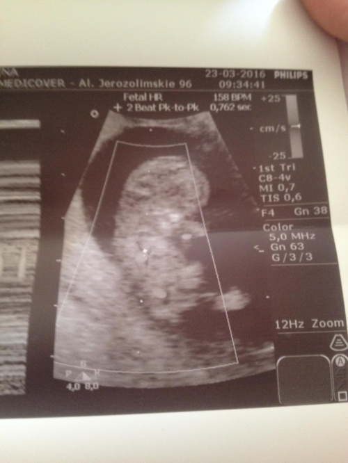 c1251b202dad36d6med.jpg